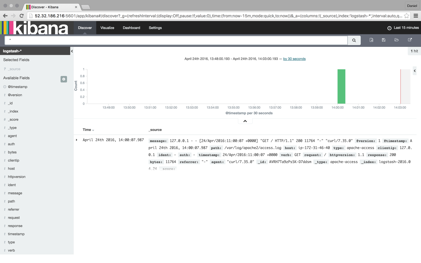 Kibana interface